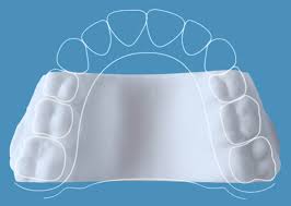 Invisalign McNamara Orthodontics in Ann Arbor, MI