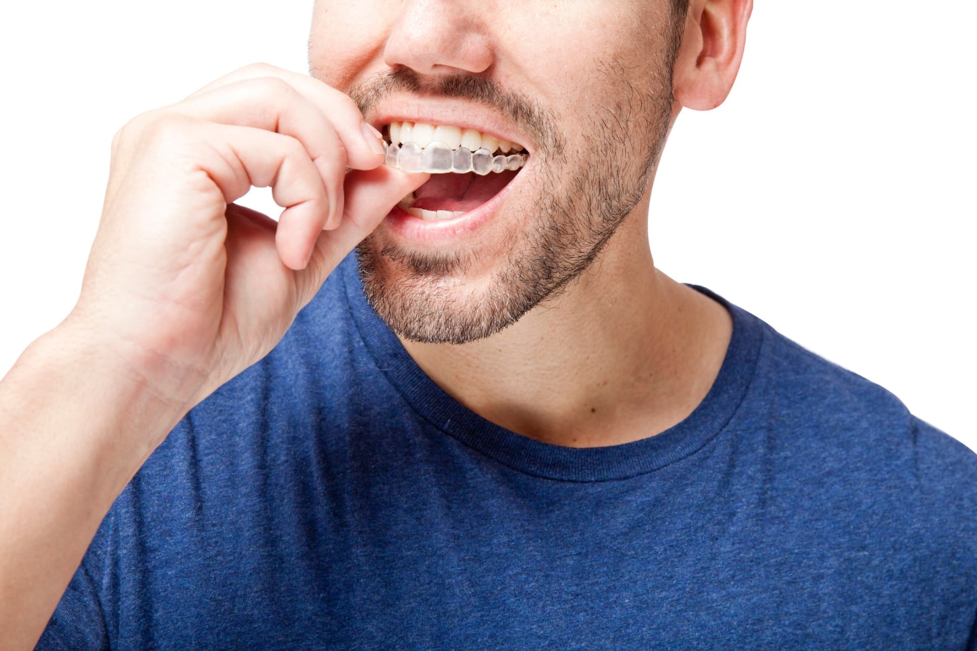 How Can You Relieve Invisalign Pain in the First Few Days? McNamara Orthodontics in Ann Arbor, MI